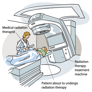 Radiation Therapy