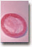 Protect yourself from STIs