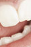 Are you your tooth enamel's worst enemy?