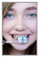 How to clean around braces