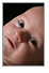 Babies get acne, too?