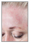 Votre peau est couverte de taches?