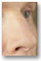 A nose for relief?