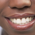 Les diffrents moyens dendommager ses dents