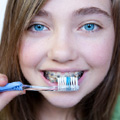 Brace Yourself for Braces