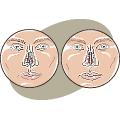 A deviated septum (left) can be corrected with a septoplasty procedure (right). 