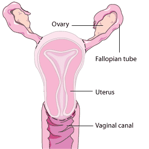 L'utérus est enlevé, les trompes de Fallope et le vagin restent intacts. Les hachures indiquent comment se fait l'ablation de l'utérus au cours d'une hystérectomie.