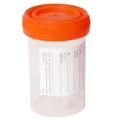 Example of a sterile container that may be used to collect a urine sample.