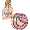 An endoscope shown traveling through the stomach and first part of the small intestines.