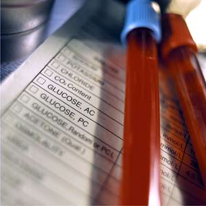 Sang qui doit être analysé en laboratoire. Sang qui doit être analysé en laboratoire.