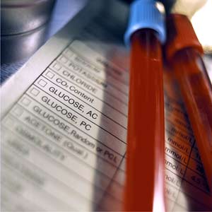 Blood that requires testing in a laboratory.