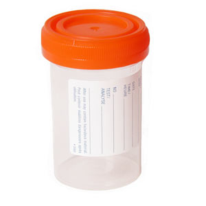 Example of a sterile container that may be used to collect a urine sample.