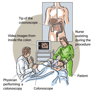 A physician shown performing a colonoscopy. Video imaging is used during the procedure.