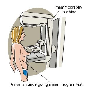 A woman undergoing a mammogram test