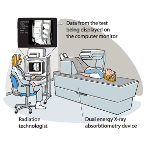 DEXA scan preparation